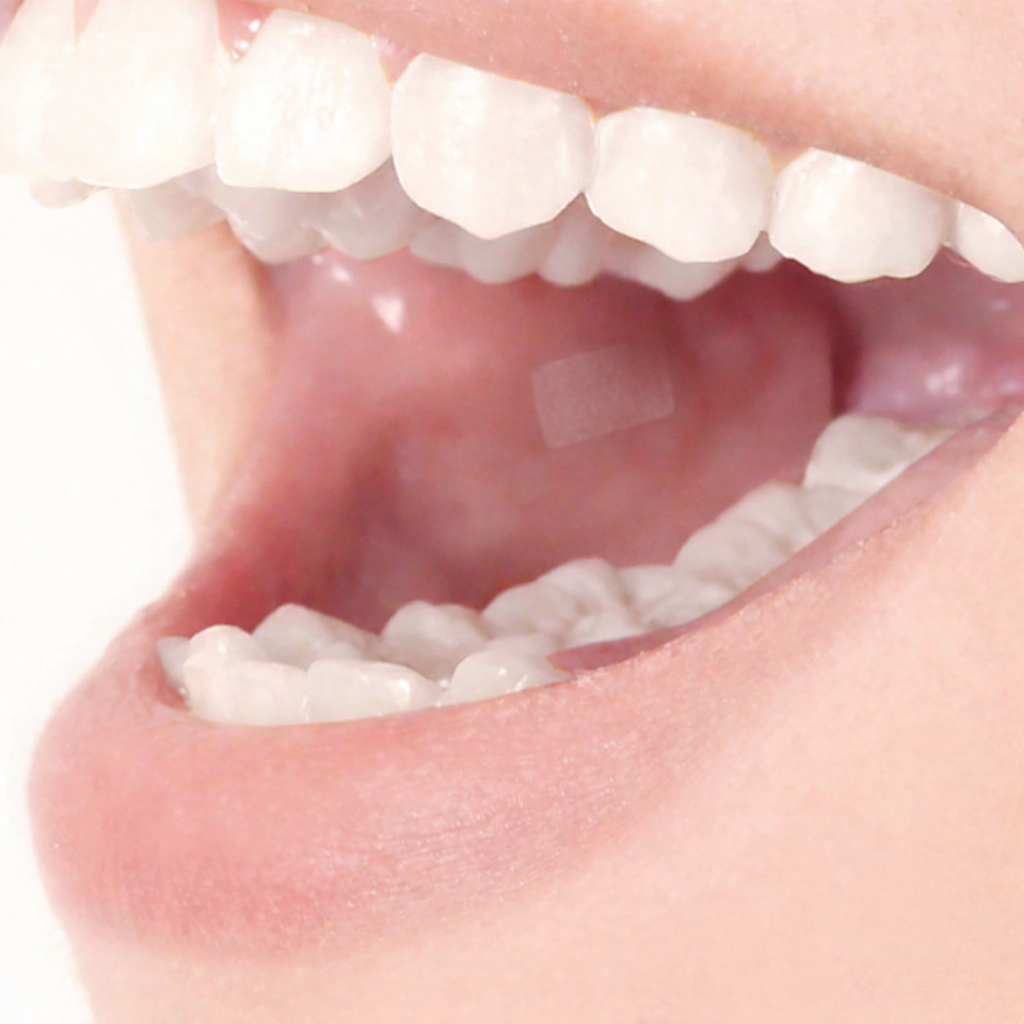 Strip applied to cheek